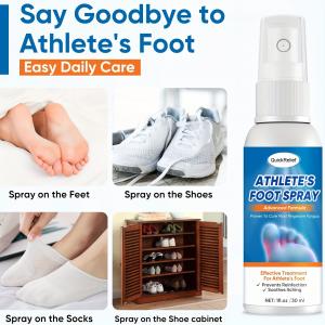 Athlete’s Foot Spray 60ml